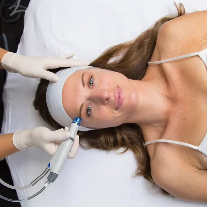Hydrafacial – The Treatment Your Skin Will Love